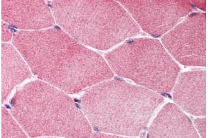 Human Skeletal Muscle (formalin-fixed, paraffin-embedded) stained with TSC1 antibody ABIN214014 at 5 ug/ml followed by biotinylated goat anti-rabbit IgG secondary antibody ABIN481713, alkaline phosphatase-streptavidin and chromogen. (TSC1 抗体  (C-Term))