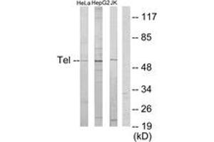 Western blot analysis of extracts from HeLa/HepG2/Jurkat cells, using ETV6 Antibody. (ETV6 抗体  (AA 371-420))