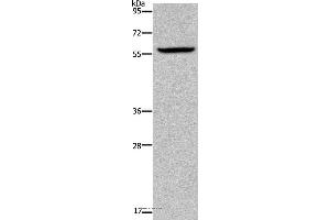 Western blot analysis of Human fetal brain tissue, using KDM4D Polyclonal Antibody at dilution of 1:1100 (JMJD2D 抗体)