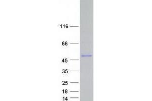 Western Blotting (WB) image for Abl-Interactor 1 (ABI1) (Transcript Variant 12) protein (Myc-DYKDDDDK Tag) (ABIN2714284)