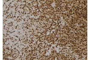 ABIN6256841 and ABIN6273600 at 1/100 staining Human spleen tissue by IHC-P.