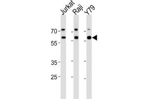 Western Blotting (WB) image for anti-Acetylcholinesterase (AChE) antibody (ABIN3003530) (Acetylcholinesterase 抗体)