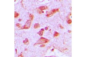 Immunohistochemical analysis of Praja2 staining in human brain formalin fixed paraffin embedded tissue section. (PJA2 抗体  (Center))