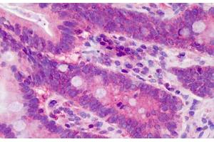 Immunohistochemistry (Formalin-fixed Paraffin-embedded Sections) (IHC (fp)) image for anti-Polymerase (DNA-Directed), delta Interacting Protein 3 (POLDIP3) (AA 326-375) antibody (ABIN6741591)