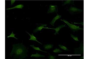 Immunofluorescence of monoclonal antibody to PURA on HeLa cell.