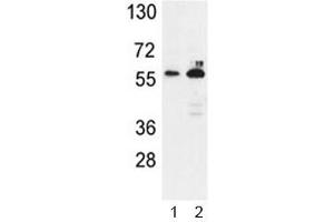 Western blot analysis of G6PD antibody and 1) K562, 2) MCF-7 lysate.