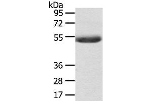 Western Blot analysis of Mouse plasma tissue using AGPAT6 Polyclonal Antibody at dilution of 1:400 (AGPAT6 抗体)