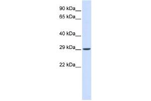 WB Suggested Anti-VTI1A Antibody Titration: 0. (VTI1A 抗体  (N-Term))