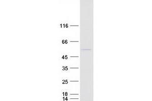 Western Blotting (WB) image for RNA-Binding Protein NOB1 (NOB1) protein (Myc-DYKDDDDK Tag) (ABIN2727436)