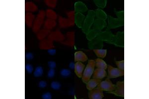ABIN6261496 and ABIN6278566 staining Hela cells(30 min of UV treatment) by IF/ICC.
