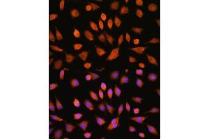 Immunofluorescence analysis of L929 cells using PI4KA Rabbit pAb (ABIN7269286) at dilution of 1:100. (PI4KA 抗体)