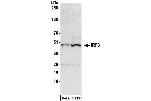 Western Blotting (WB) image for anti-Interferon Regulatory Factor 3 (IRF3) (AA 100-150) antibody (ABIN7449377)