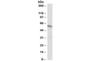 Western blot testing of A431 lysate and RXR beta antibody at 1ug/ml. (Retinoid X Receptor beta 抗体)