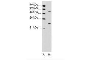 Image no. 1 for anti-3-phosphoinositide Dependent Protein Kinase-1 (PDPK1) (AA 201-250) antibody (ABIN6736342) (PDPK1 抗体  (AA 201-250))