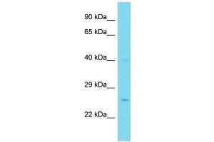 Host: Rabbit Target Name: PPP1R35 Sample Type: Jurkat Whole Cell lysates Antibody Dilution: 1. (PPP1R35 抗体  (N-Term))