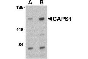 Western blot analysis of CAPS1 in rat brain tissue lysate with AP30178PU-N CAPS1 antibody at (A) 0. (CADPS 抗体  (C-Term))