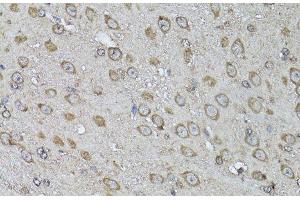 Immunohistochemistry of paraffin-embedded Mouse brain using Snail Polyclonal Antibody at dilution of 1:100 (40x lens). (SNAIL 抗体)