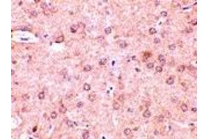 Immunohistochemistry (IHC) image for anti-Beclin 1, Autophagy Related (BECN1) (N-Term) antibody (ABIN1031269) (Beclin 1 抗体  (N-Term))