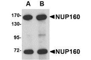 Image no. 1 for anti-Nucleoporin 160kDa (NUP160) (C-Term) antibody (ABIN1103361) (NUP160 抗体  (C-Term))