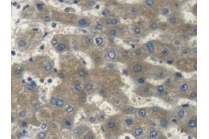 Immunohistochemistry (IHC) image for anti-Myosin (AA 1069-1331) antibody (ABIN7439273)