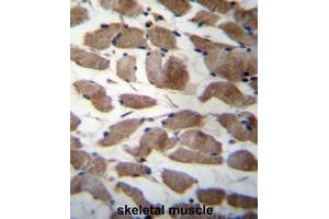 ACTN3 Antibody (Center) immunohistochemistry analysis in formalin fixed and paraffin embedded human skeletal muscle followed by peroxidase conjugation of the secondary antibody and DAB staining. (ACTN3 抗体  (Middle Region))