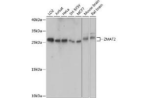 Western Blotting (WB) image for anti-Zinc Finger, Matrin Type 2 (ZMAT2) (AA 1-199) antibody (ABIN7271560)