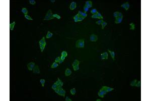 Immunofluorescence staining of Hela cells with ABIN7145214 at 1:100, counter-stained with DAPI. (BAG3 抗体  (AA 220-420))