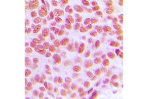 Immunohistochemistry (IHC) image for anti-Transcription Factor AP-2 gamma (Activating Enhancer Binding Protein 2 Gamma) (TFAP2C) (C-Term) antibody (ABIN7299486)