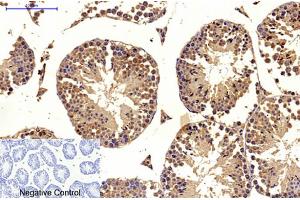 Immunohistochemical analysis of paraffin-embedded mouse testis tissue. (MICU1 抗体)