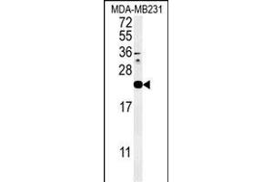 Western blot analysis of IL1F6 Antibody (Center) (ABIN651427 and ABIN2840233) in MDA-M cell line lysates (35 μg/lane). (IL36A/IL1F6 抗体  (AA 35-61))