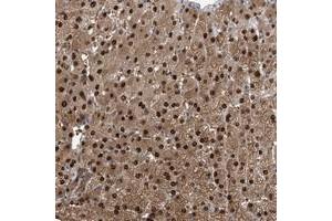 Immunohistochemical staining of human liver with C11orf73 polyclonal antibody  shows strong nuclear and cytoplasmic positivity in hepatocytes at 1:500-1:1000 dilution. (C11orf73 抗体)