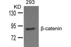 Western blot analysis of extracts from 293 cells and using β-catenin. (CTNNB1 抗体  (AA 327-331))