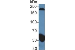 Western Blot; Sample: Human Serum; Primary Ab: 5µg/ml Rabbit Anti-Human gSAP Antibody Second Ab: 0. (GSAP 抗体  (AA 616-854))