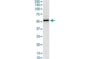 Western Blotting (WB) image for anti-Serpin Family H Member 1 (SERPINH1) (AA 1-418) antibody (ABIN560200)