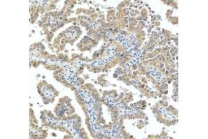 IHC analysis of PACT/PRKRA using anti-PACT/PRKRA antibody (ABIN7600141).