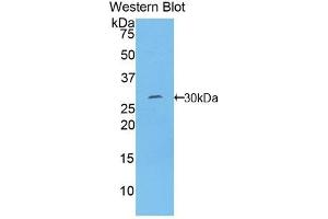 Detection of Recombinant TOR1B, Human using Polyclonal Antibody to Torsin 1B (TOR1B) (TOR1B 抗体  (AA 98-327))