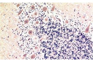 Immunohistochemistry of paraffin-embedded Human brain tissue using MAP1LC3B Monoclonal Antibody at dilution of 1:200. (LC3B 抗体)