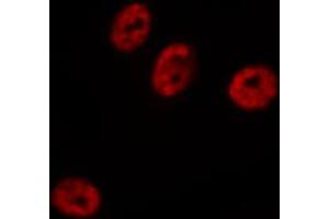 ABIN6272454 staining HeLa by IF/ICC. (Cytidine Monophosphate (UMP-CMP) Kinase 1, Cytosolic (CMPK1) (N-Term) 抗体)