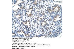 Rabbit Anti-CEACAM6 Antibody  Paraffin Embedded Tissue: Human Lung Cellular Data: Alveolar cells Antibody Concentration: 4. (CEACAM6 抗体  (Middle Region))