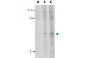Western blot analysis of RPS6KA1 in Jurkat cell lysate with RPS6KA1 polyclonal antibody  at (A) 2. (RPS6KA1 抗体  (N-Term))