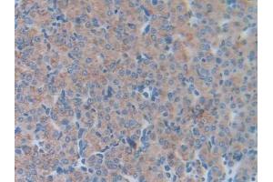 Detection of LCN5 in Mouse Ovary Tissue using Polyclonal Antibody to Lipocalin 5 (LCN5) (LCN5 抗体  (AA 28-187))