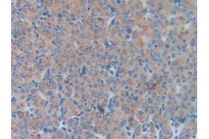 Detection of LCN5 in Mouse Ovary Tissue using Polyclonal Antibody to Lipocalin 5 (LCN5)