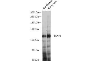 Western blot analysis of extracts of various cell lines, using SENP6 antibody (ABIN7270635) at 1:1000 dilution. (SENP6 抗体  (AA 811-1112))