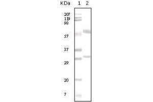 Western Blot showing ER-alpha antibody used against human breast carcinoma tissue lysate.