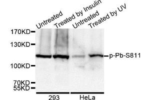 Western Blotting (WB) image for anti-Retinoblastoma 1 (RB1) (pSer811) antibody (ABIN3023610) (Retinoblastoma 1 抗体  (pSer811))