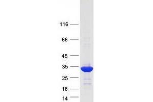 Western Blotting (WB) image for PSMC3 Interacting Protein (PSMC3IP) (Transcript Variant 1) protein (Myc-DYKDDDDK Tag) (ABIN2729968)