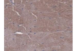Immunohistochemistry (IHC) image for anti-Folylpolyglutamate Synthase (FPGS) (AA 210-439) antibody (ABIN7444802)