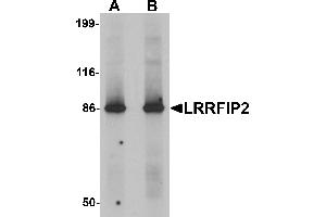 Western blot analysis of LRRFIP2 in rat colon tissue lysate with LRRFIP2 antibody at (A) 0. (LRRFIP2 抗体  (C-Term))