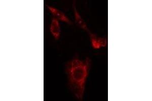 ABIN6274960 staining HuvEc cells by IF/ICC. (CA3 抗体  (N-Term))