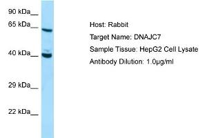 Western Blotting (WB) image for anti-DnaJ (Hsp40) Homolog, Subfamily C, Member 7 (DNAJC7) (C-Term) antibody (ABIN970539) (DNAJC7 抗体  (C-Term))